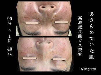 レガロビューティクリエイションズ桜川店/シミに終止符！シミを作らない肌