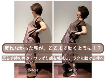 スプリング鍼灸院(Spring鍼灸院)/50代女性／慢性腰痛／動作に不安