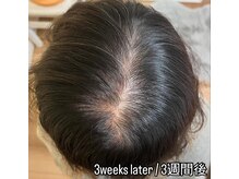 シャラ(shara)/プロセルセラピーズ