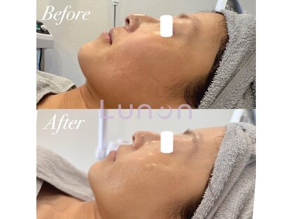 ルノン(Lunon)の写真