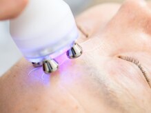 話題の切らない糸リフト☆たるみ・しわ改善・リフトアップ