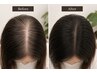 【分け目・つむじ・抜け毛】本格スカルプケア（エッセンス付）