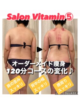 サロン ビタミンファイブ(Salon Vitamin5)/肩や背中の歪みも改善♪