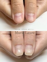 マリーロール 淀屋橋本店(Marie Laure)/自爪育成/深爪矯正/ネイルケア