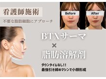 スリーメイ(3mey)の雰囲気（サーマクール×脂肪燃焼剤で切らない小顔リフト）