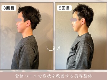 ほぐし屋 かすがい/3、5回目/猫背巻き肩矯正