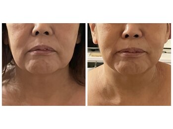 ナユラスパ(Nayula Spa)/脂肪分解レモンボトル