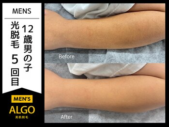 アルゴ 小松店(ALGO)/小学生男子も！