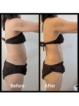 アリビオ(ALIVIO)/1ヶ月集中モニター