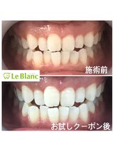 ルブラン 奈良店(Le Blanc)/イベント前に(^o^)