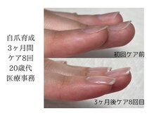 ネイルサロンアンドスクール マルベリー(mulberry)/自爪育成