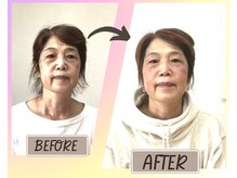 ホリハ整体院/*Before&After* 美顔デザイン