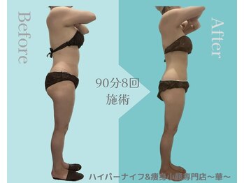 華(hana)/モニター様上半身スッキリ