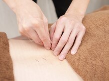 鍼灸院 はりエイト/■鍼灸施術