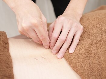 鍼灸院 はりエイト/■鍼灸施術