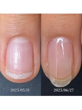 ココ(COCO)/ハンドケア・自爪育成・深爪育成