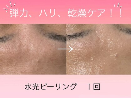 エステティック レイビス 渋谷店(RAYVIS)の写真