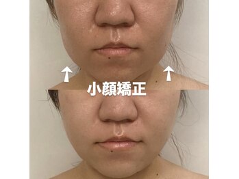 ボディヒーリングアンド小顔美容矯正 プララン/