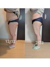 リルーチェ 倉敷(Riluce)/ぽっこりお腹撃退