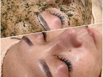 マカオン(machaon)/ハーブピーリング