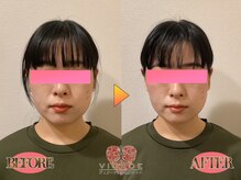 【小顔/リフトアップ/姿勢/骨盤矯正/頭蓋骨/痩身】ヴィオーデ美容整体サロン那覇店/小顔、リンパ、ヘッドスパ、整体