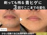 【青ヒゲ・肌荒れに】少ない回数で卒業を目指すヒゲ脱毛 ¥11,800→初回¥9,200