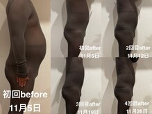 ミ ライト(m light)/むだ肉をなくす！全身コース