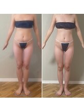 ラフォクシー(La.Foxy)/毎月のメンテナンスに入るたびに