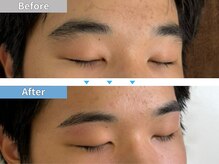 マユクリア 埼玉大宮店/美眉B/A [眉毛/眉毛サロン/大宮]