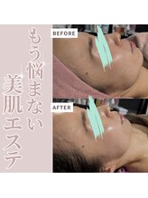 レアナ(LEANA)/美肌　フェイシャルメニュー