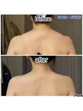 ノリスズ(NORI SUZU)/肩こりでパンパンな僧帽筋も◎