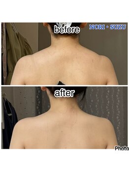 ノリスズ(NORI SUZU)/肩こりでパンパンな僧帽筋も◎