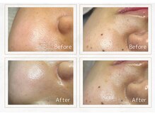 セレーノ 横浜(seReno)/潤艶ワックス 頬のビフォアフ