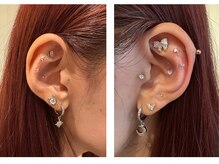 四条大宮アシスト鍼灸整骨院/耳ツボジュエリー