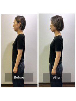 シャルム(CHARMEB)/スマホ首の方にオススメ！