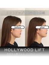 ブリリオプラス 広島並木店(Brillio Plus)/2倍打ち★速攻小顔コース