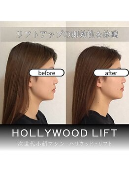 ブリリオプラス 広島並木店(Brillio Plus)/2倍打ち★速攻小顔コース