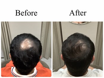 アンス(anth:)/お客様仕上がり