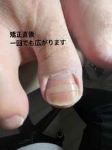 サロン こころ/爪の施術後