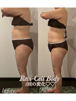 マージェ(magie)/県勇逸/認定サロンReviCell-Body