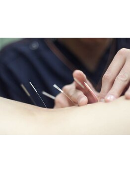 鍼灸施術を受けたい