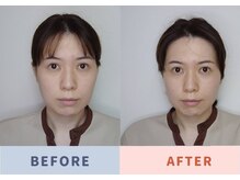 ナゴミゴッド(Nagomi GOD)の雰囲気（面長のお顔も、たまご型に！！眉の位置も変わりスッキリ小顔へ）