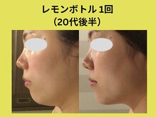 リンク 錦糸町店(Link)/レモンボトル1回