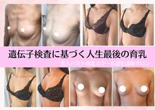 美バストアルファ(美bust α)