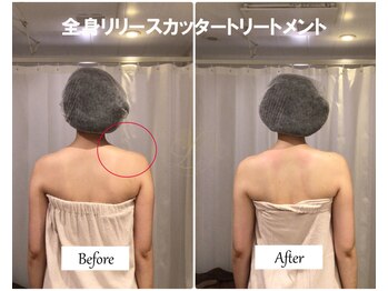 リノ(Lino)/全身リリースカッター