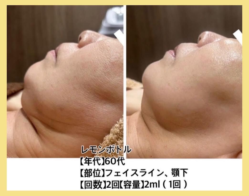 リファインプロ ダイエット エステ 酵素ファスティングダイエット｜【Rune Tirtha】ルネティルタ