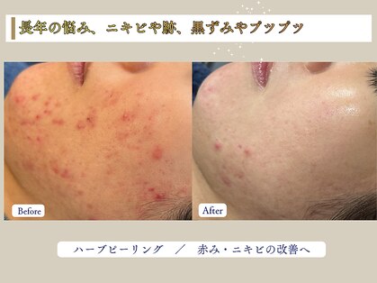 ルアナ 柏本店(LUANA)の写真