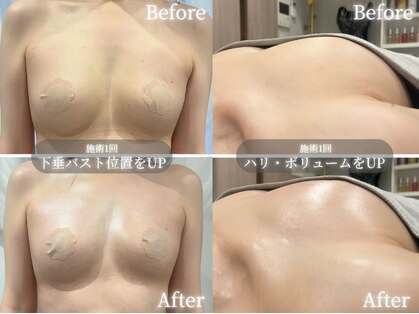 キョクセンビ 武蔵小杉(KYOKUSENBI)の写真
