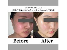 インフィニーズ(INFINEEZ)の雰囲気（肌質改善スペシャルコースはエステティックアワード殿堂入り♪）