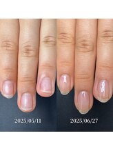 ココ(COCO)/ハンドケア・自爪育成・深爪育成